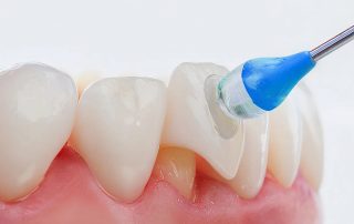 das-labor-adhaesive-befestigung